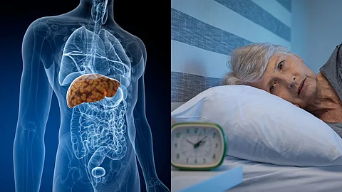 Liver Disease