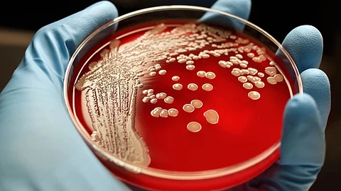 Superbug