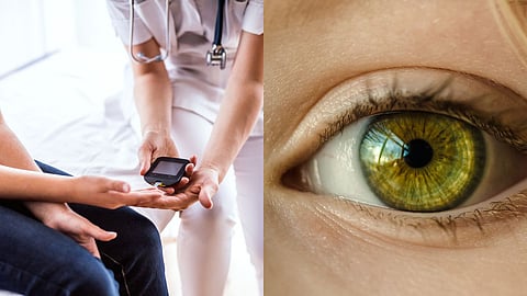Diabetes Effect on Eyes