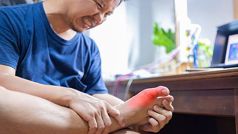 How To Reduce Uric Acid