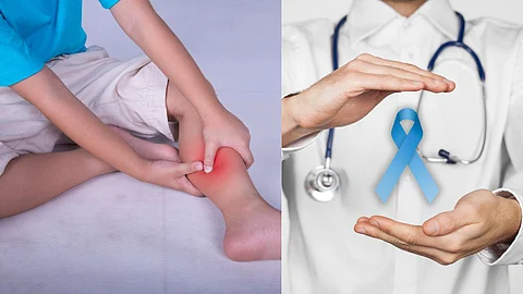 Bone Cancer