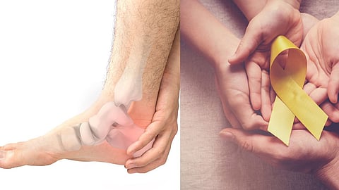 Bone Cancer Symptoms in Legs
