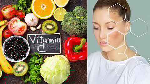 Vitamin C Deficiency