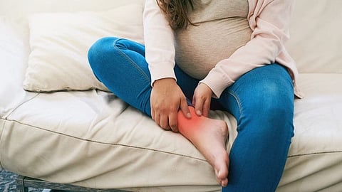 Swelling In Pregnancy