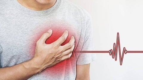 Heart Attack