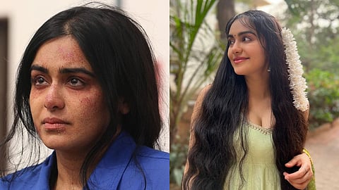 Adah Sharma : अदा शर्माला 'बस्तर'च्या शुटिंगवेळी झाला होता गंभीर आजार, अभिनेत्रीने स्वत:च केला खुलासा