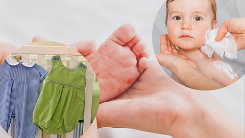 Baby Allergy Prevention Tips