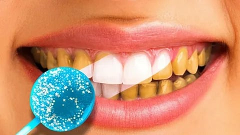 How To Remove Plaque From Teeth