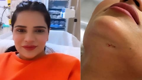 Archana Gautam Injured