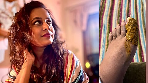 Hemangi Kavi Accident During Shooting