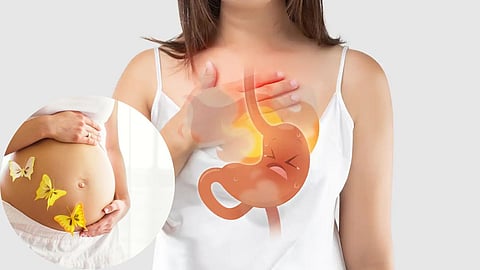 Acidity During Pregnancy