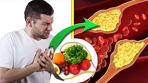 High Cholesterol Food