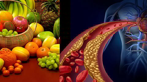 High Cholesterol Food