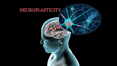 Neuroplasticity