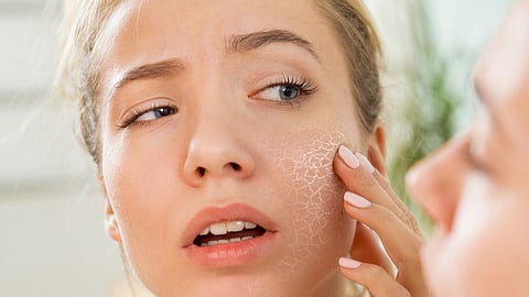 Winter Beauty Tips