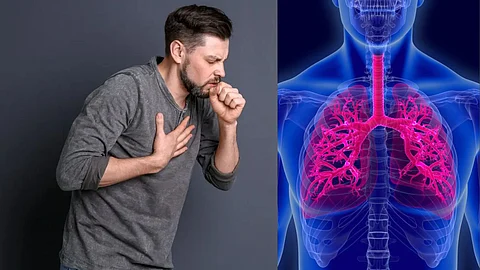 Pneumonia Causes