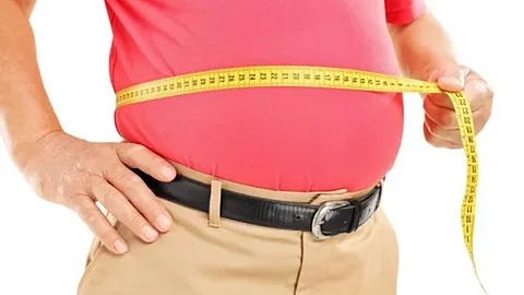 Bariatric Surgery