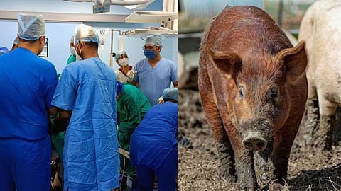 Pig Kidney Transplanted into Person
