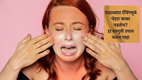 How To Remove Tan: उन्हाळ्यात टॅनिंगमुळे चेहरा काळा पडतोय? हा घरगुती उपाय करुन पाहा