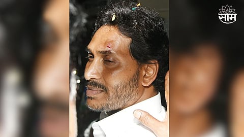 आंध्र प्रदेशच्या मुख्यमंत्र्यांवर दगडफेक, हल्ल्यात जगनमोहन रेड्डी जखमी