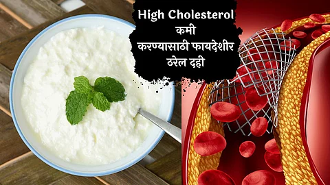 High Cholesterol, Cholesterol Disease