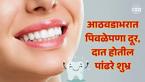 Teeth Whitening Tips