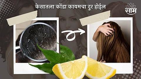 Dandruff Removal with Lemon