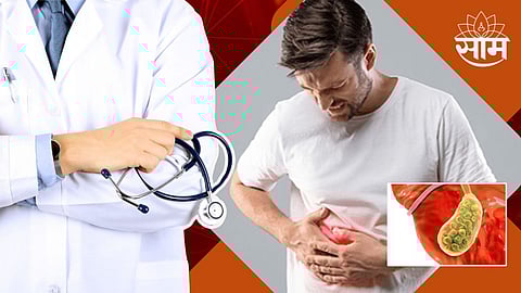 Gallstones Misunderstandings