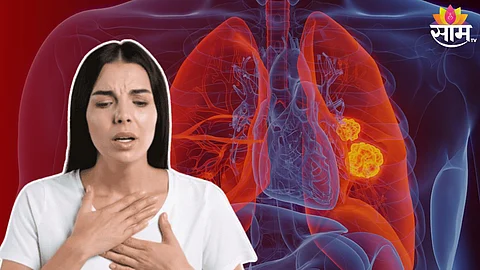 Lung Cancer