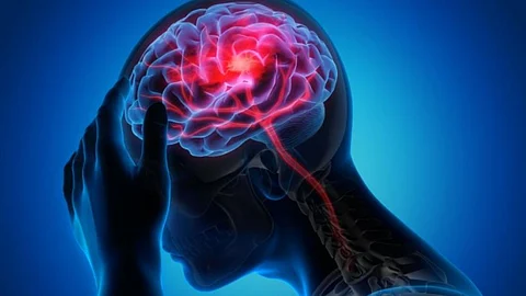 How To Identify Blood Clot in Brain