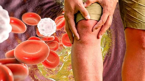 High cholesterol symptoms