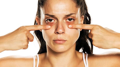 Beauty Skin Tips
