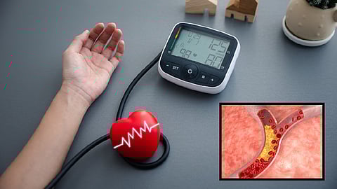 Hypertension and High Cholesterol