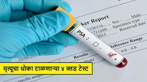 How To Diagnose Cancer