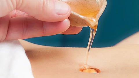 castor oil in belly button
