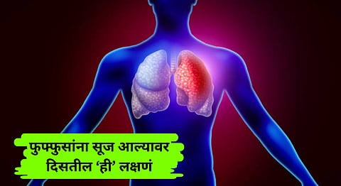 Symptoms Of Swelling In Lungs