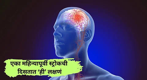 Stroke Symptoms 1 Month Before