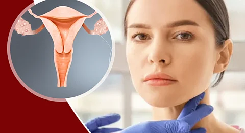 PCOS and Thyroid