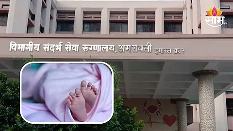 Buldhana News: नवजात बाळाच्या पोटात एक नव्हे तर दोन मृत अर्भक, गुंतागुंतीची शस्त्रक्रिया यशस्वी