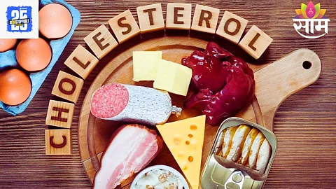 Cholesterol