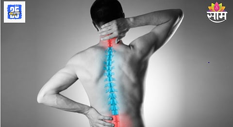 Cervical spondylosis