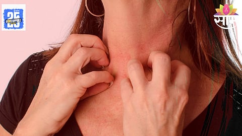 Summer Skin Problems