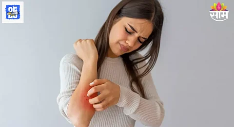 Skin allergy: किती आहेत त्वचेच्या अॅलर्जीचे प्रकार? जाणून घ्या परिणाम आणि घरगुती उपचार
