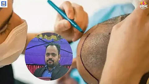 hair transplant vinita dubey death