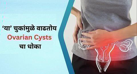 Ovarian cysts