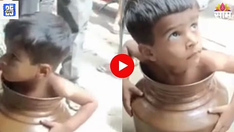 Boy Stuck In Metal Pot