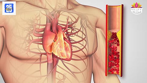 Early symptoms of Heart blockage
