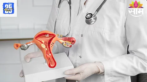 PCOS Tips