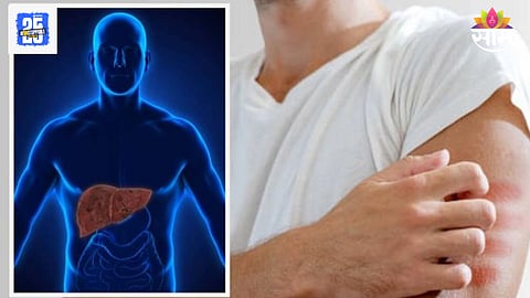 Liver Disease Symptoms