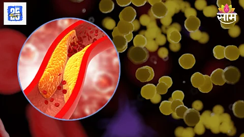 High cholesterol no symptoms dangerous